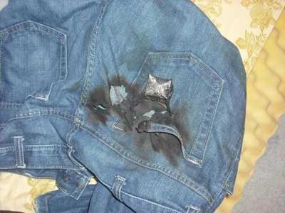 被电池烧毁的裤子